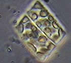 Diatomácea - Anaulus sp